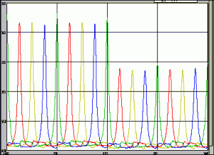 Variable Compression Ratio